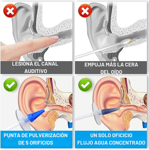 Kit Medicado de Limpieza total de Oídos +10 Boquillas intercambiables Gratis