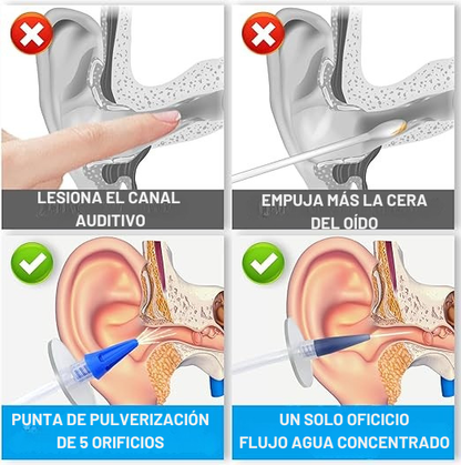 Kit Medicado de Limpieza total de Oídos +10 Boquillas intercambiables Gratis
